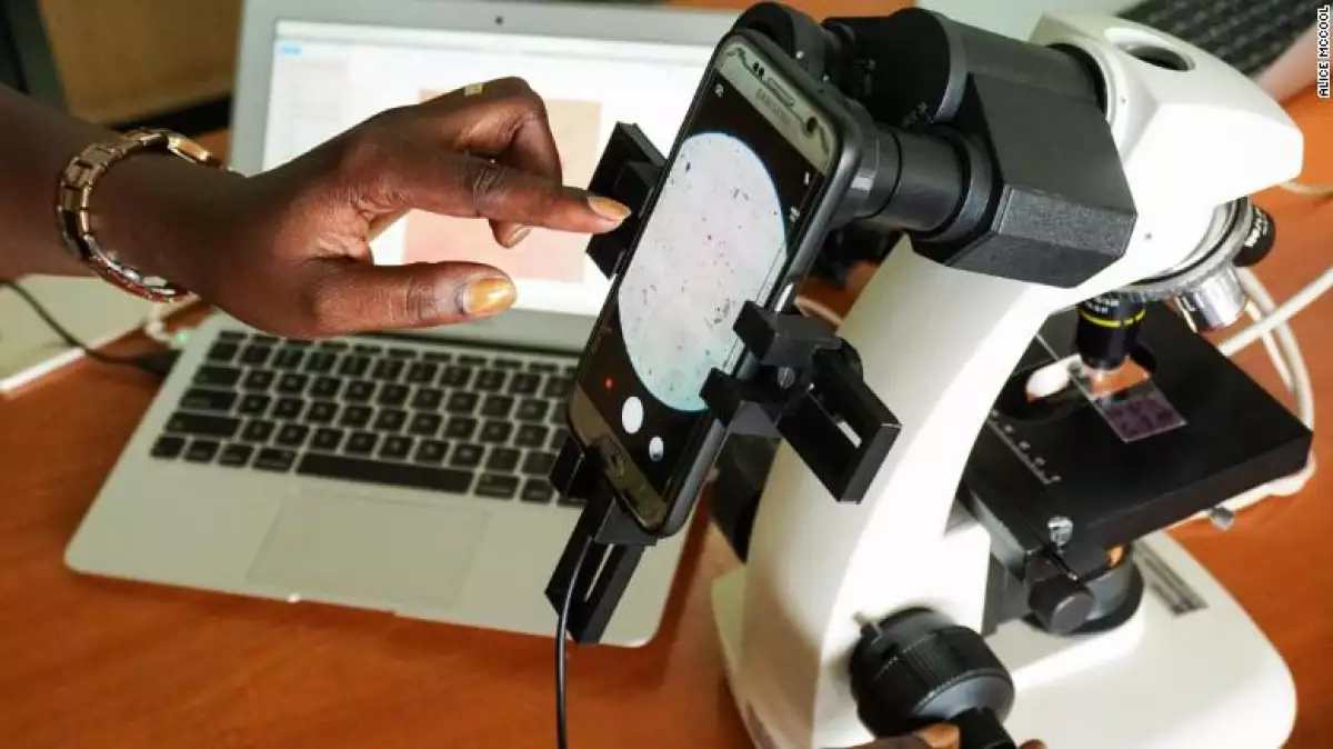 Los resultados del primer prototipo de iMAGING malaria IA