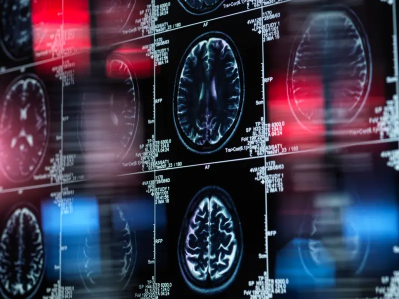 Enfermedad Cerebro Comportamiento