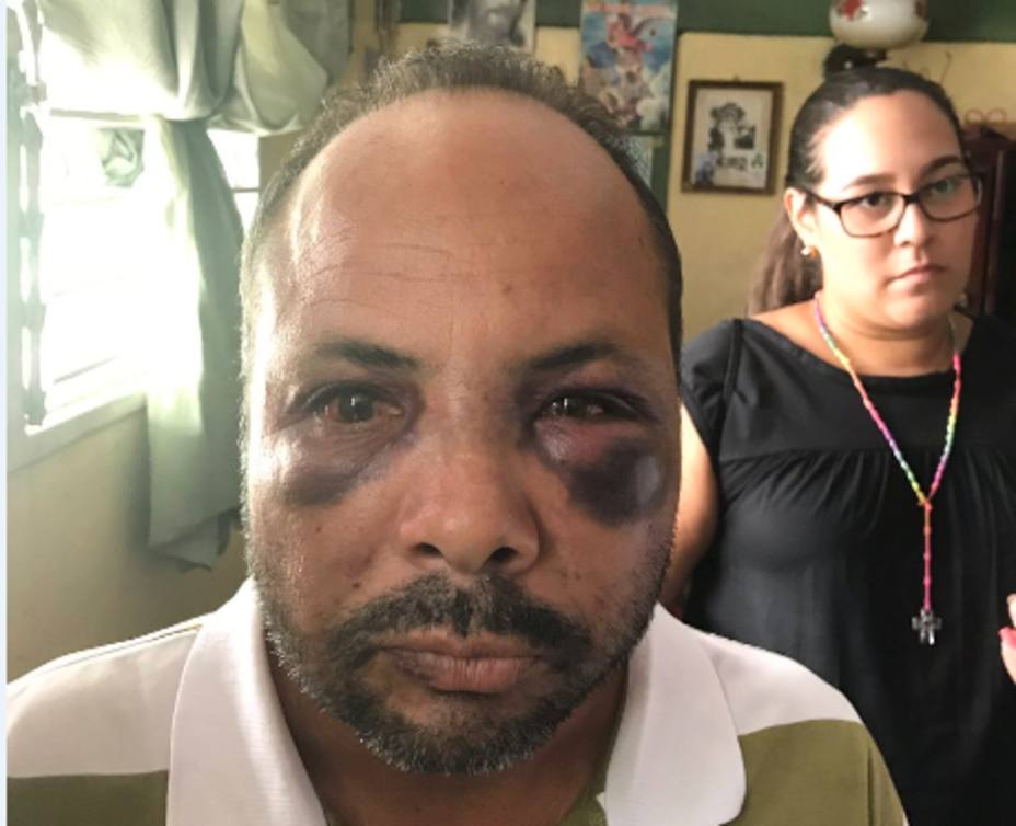 vecinos-barquisimeto-denuncian-agresiones-grupos-armados_179736.jpg