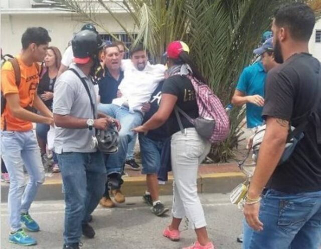 Freddy Guevara recibió doce puntos luego de impacto con bomba lacrimógena