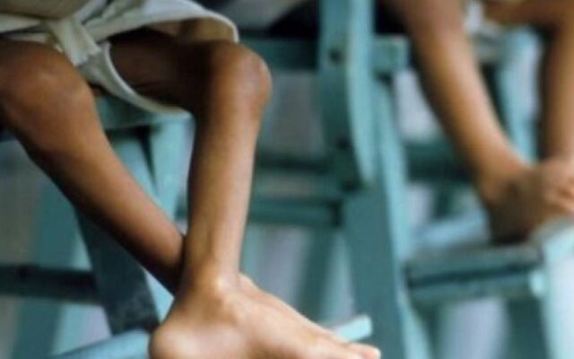 Afirman que la desnutrición continúa haciendo estragos en Venezuela