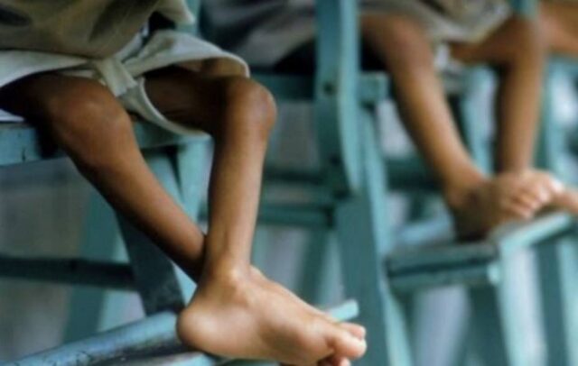 35 niños desnutridos ingresaron al hospital de Valera este trimestre