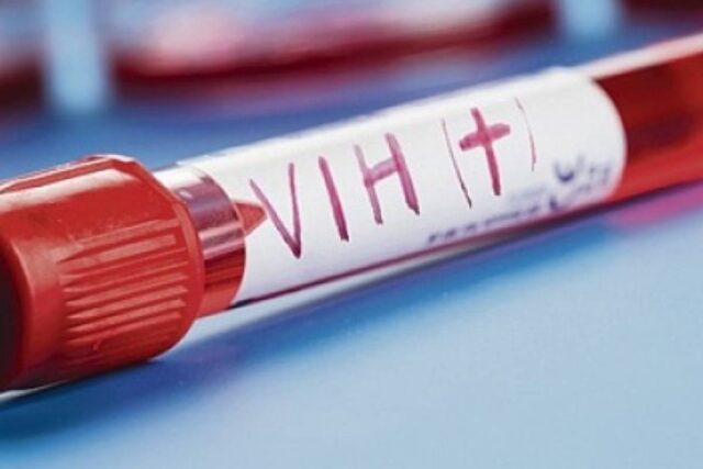 Seis pacientes con VIH tras recibir órganos infectados en Brasil