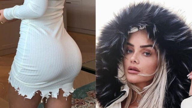 Sophie Elise, la influencer noruega que quiere quitarse los implantes que se puso en las nalgas