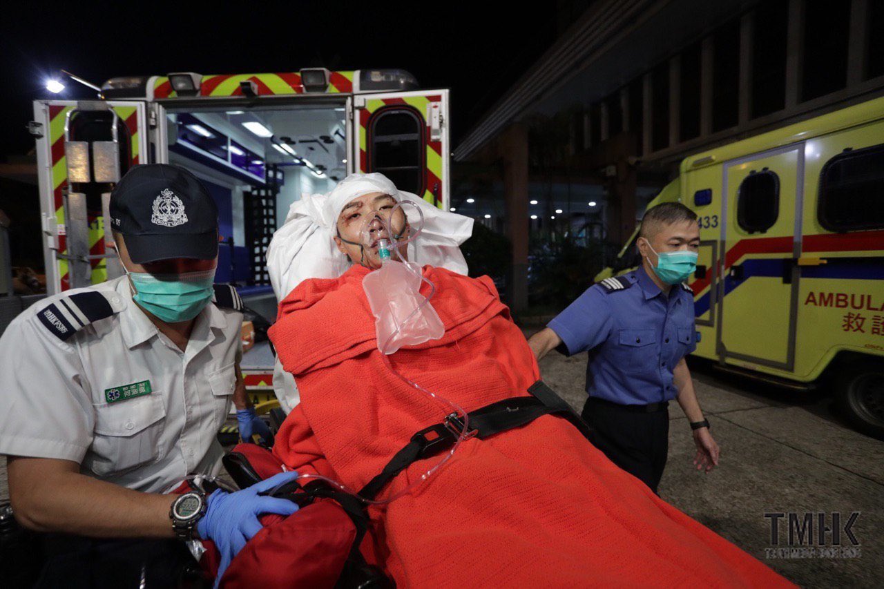 Atacan a martillazos a líder de las protestas en Hong Kong