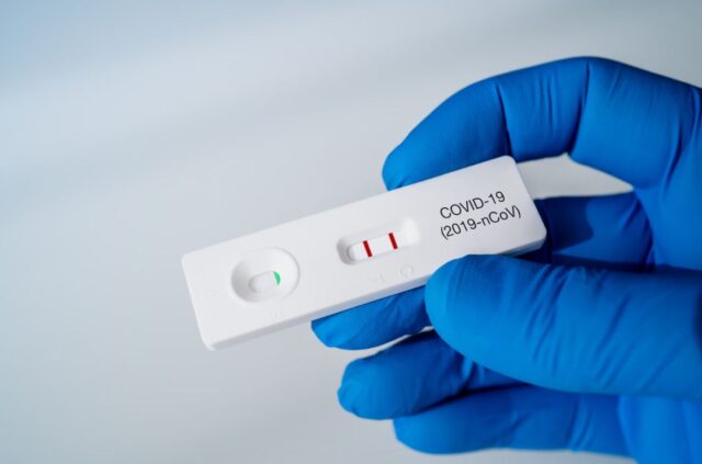 OMS: Casos de covid-19 aumentaron 30% a nivel mundial