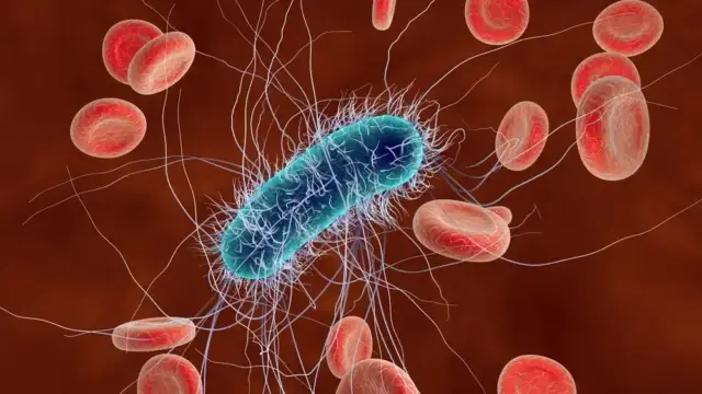 E. Coli: ¿qué tan grave es la bacteria que afectó a deportista olímpica en el río Sena?