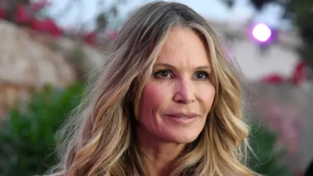 Elle Macpherson prefiere un "enfoque holístico" para tratar su cáncer de mama