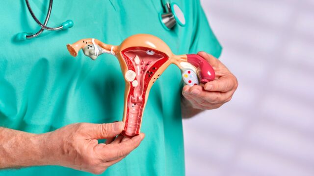 Los médicos le dijeron que tenía una infección urinaria y después le diagnosticaron cáncer: “Mi tumor era tan grande que tenía cabello y dientes”