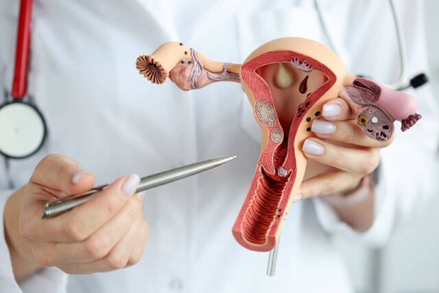 ¿Por qué aumentan los casos de cáncer de útero en el mundo?
