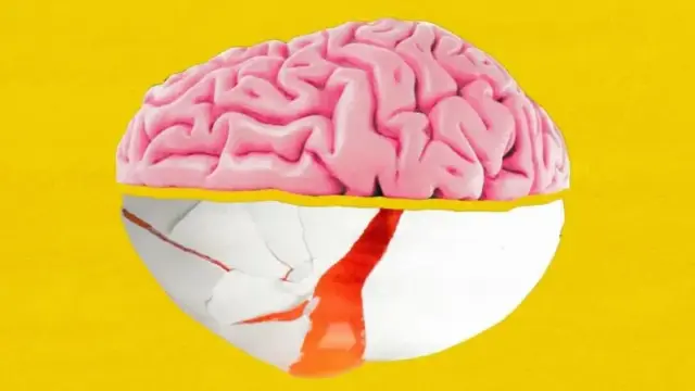 Qué es la colina, el nutriente que es vital para nuestro cerebro (y en qué alimentos se encuentra)
