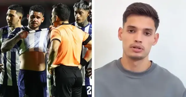 Así pidió disculpas Damián Bobadilla por los insultos racistas al venezolano Miguel Navarro